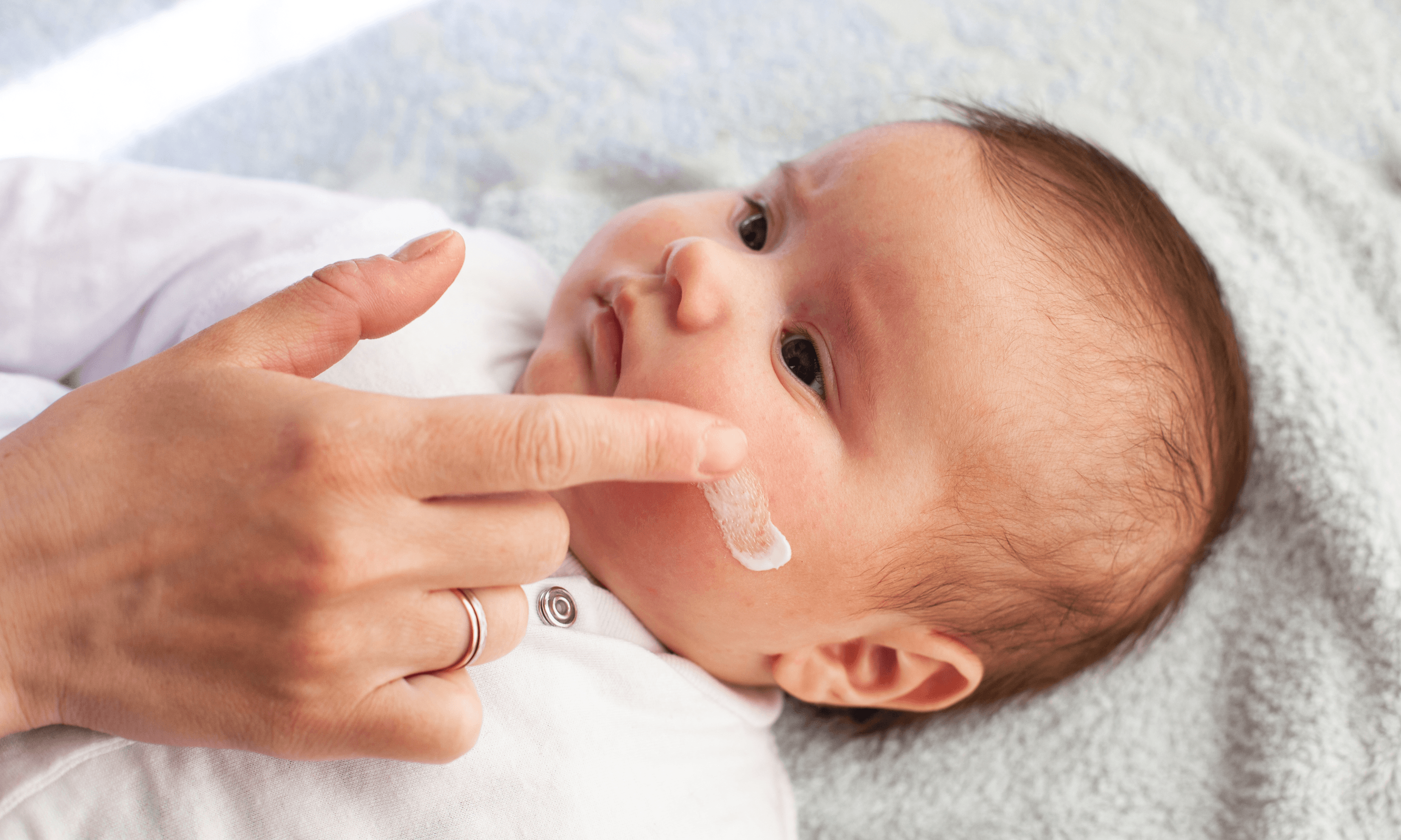 Baby Eczema Essentials 